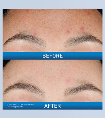 Resurfacing Retinol Serum
